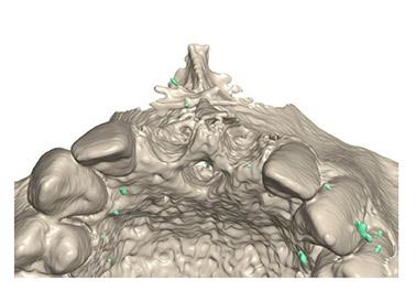 3D-Ansicht des Gebisses von oben