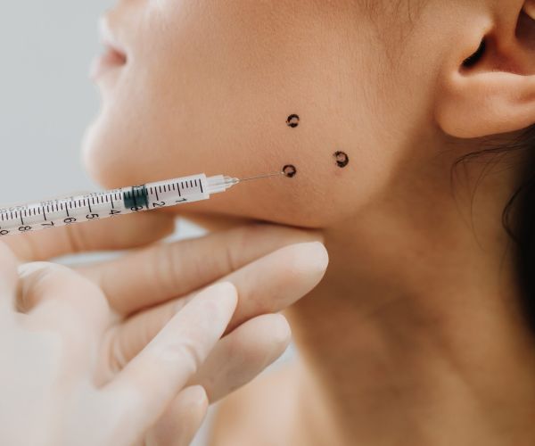 Bruxismus-Injektion mit Botox in Andernach