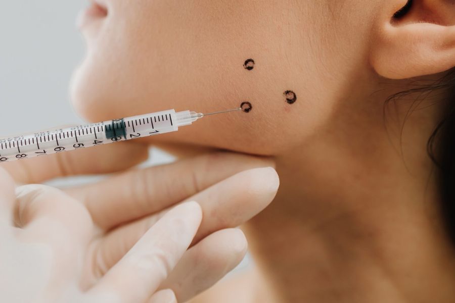 Bruxismus-Injektion mit Botox in Andernach