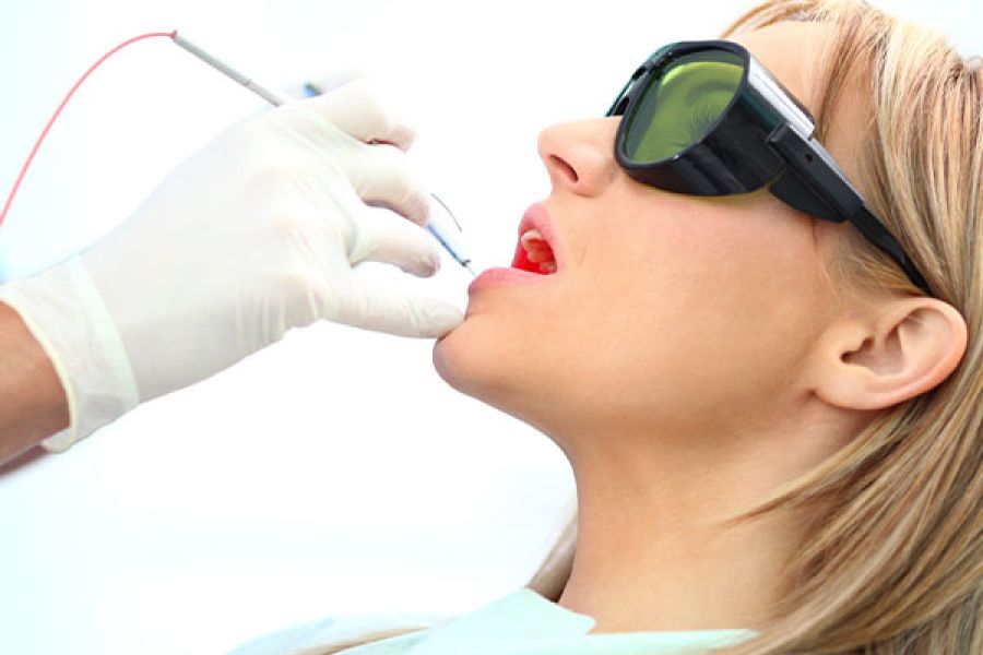 Diodenlaser Zahnarzt Andernach